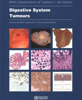 Digestive System Tumours Cheap